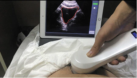 Urologie interventionnelle et techniques mini-invasives à Marrakech